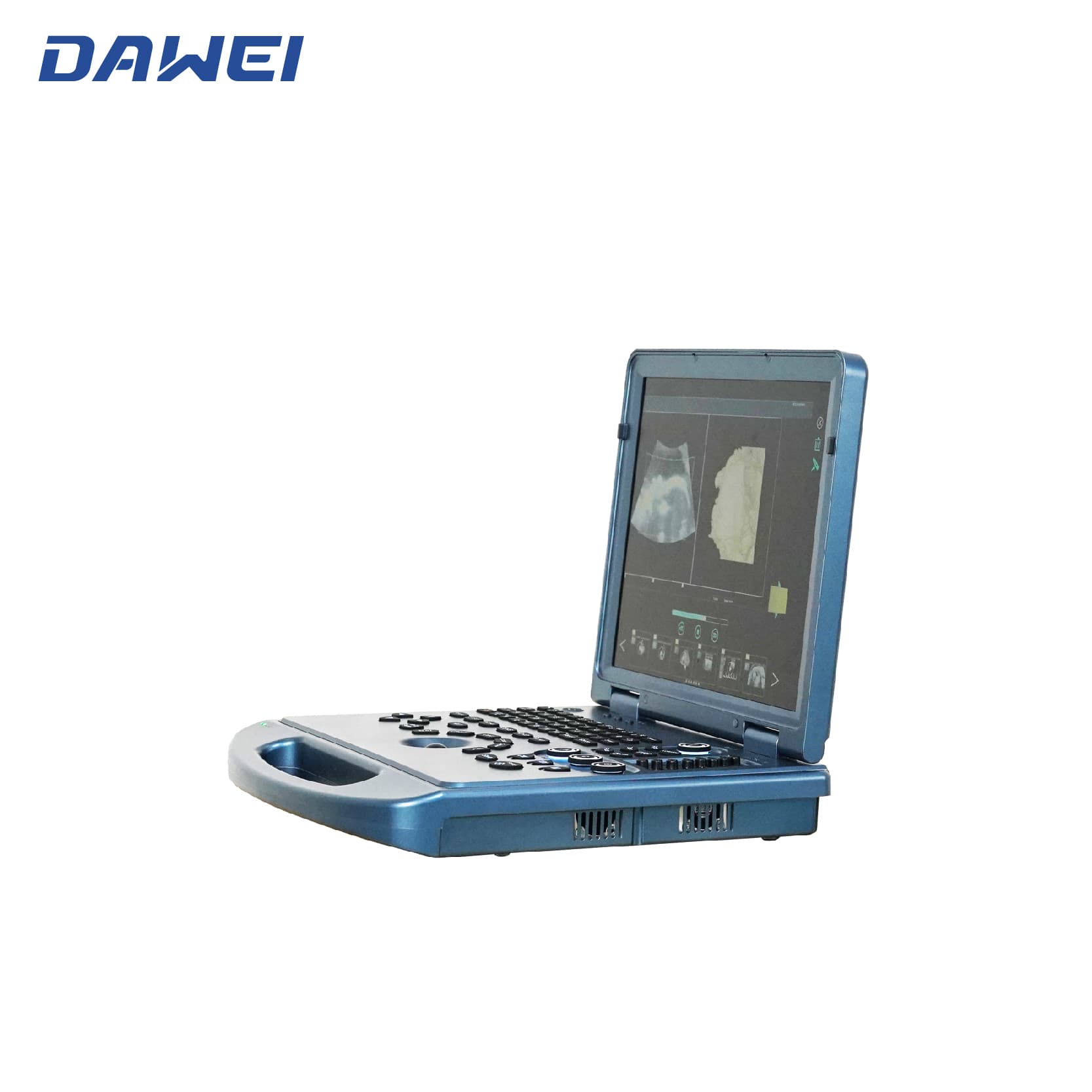 Sistema de ultrassom de laptop 4D acessível Sistema de ultrassom de laptop 4D acessível