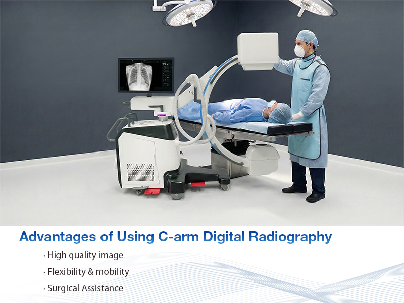 advantages of using C-arm digital radiography vantagens do uso da radiografia digital com arco C