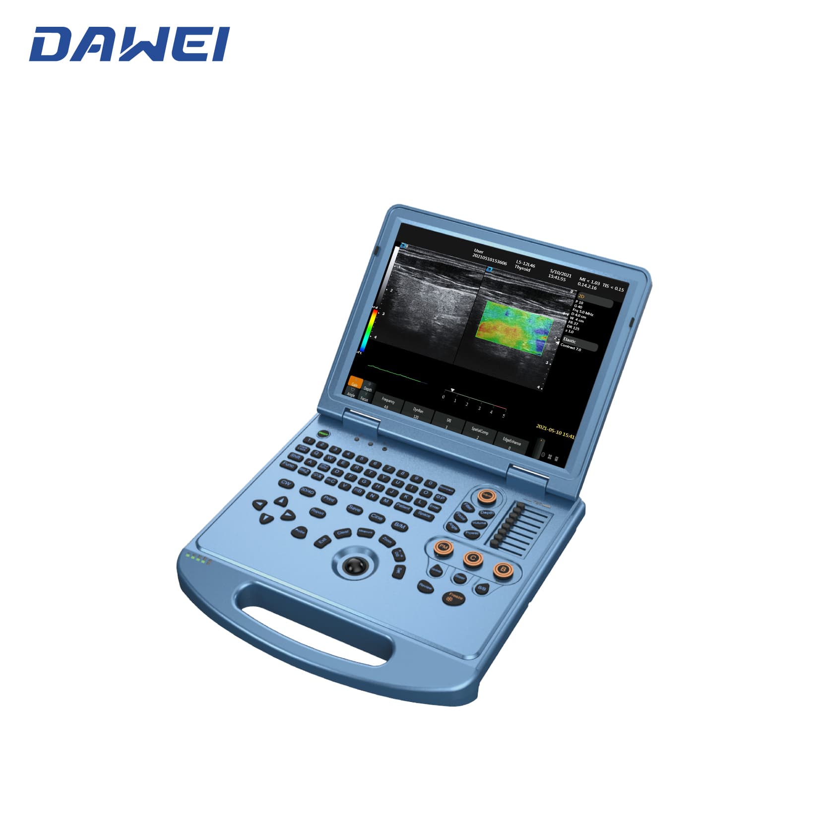 Sistema de ultrassom de laptop 4D acessível Sistema de ultrassom de laptop 4D acessível