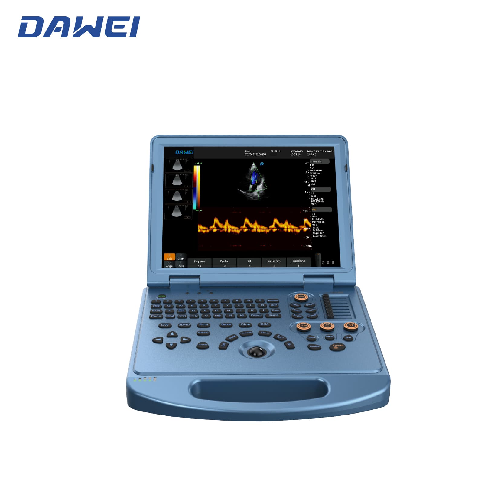 Sistema de ultrassom de laptop 4D acessível Sistema de ultrassom de laptop 4D acessível