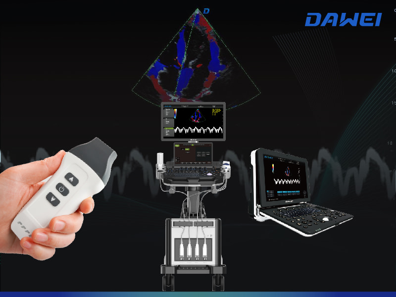 Breakthrough in Motion and Blood Flow Imaging Avanço em imagens de movimento e fluxo sanguíneo