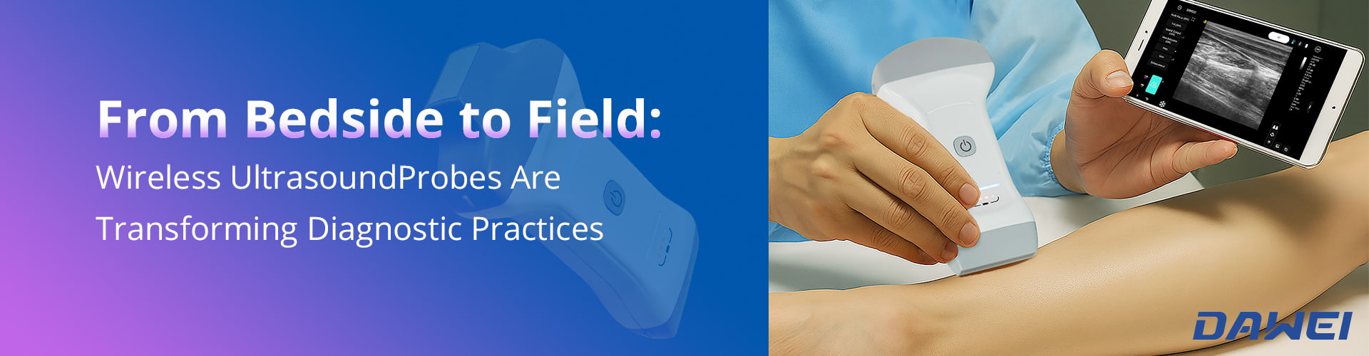 From Bedside To Field How Wireless Ultrasound Probes Are Transforming Diagnostic Practices Da cabeceira ao campo Como as sondas de ultrassom sem fio estão transformando as práticas de diagnóstico