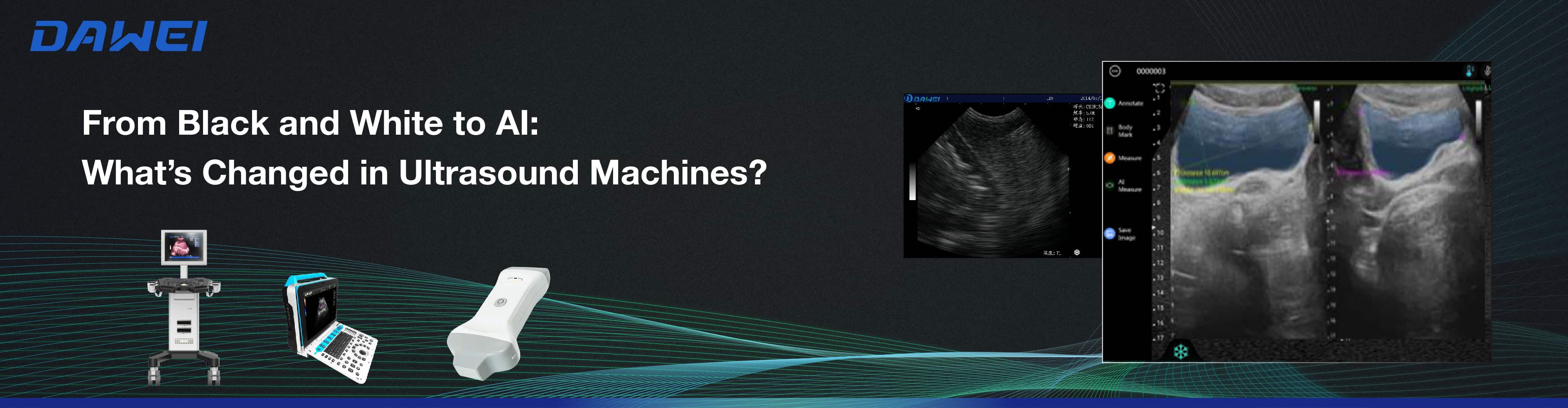 From Black and White to AI What’s Changed in Ultrasound Machines Do preto e branco à IA O que mudou nas máquinas de ultrassom
