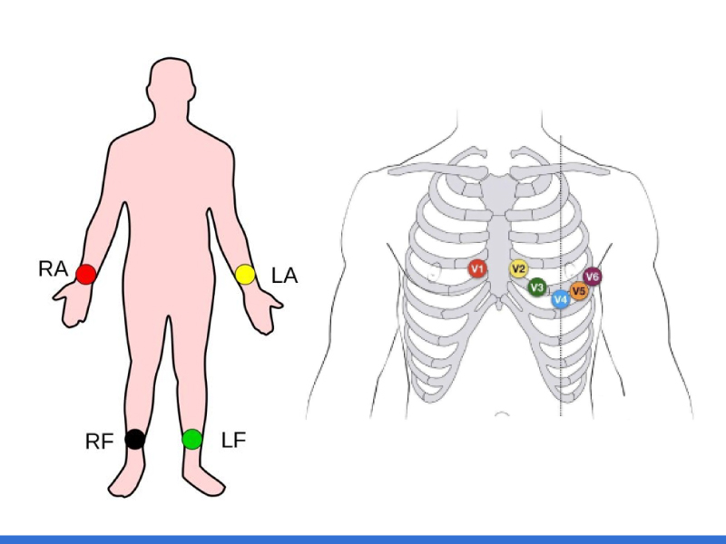 Componentes de chave de colocação do eletrodo ECG