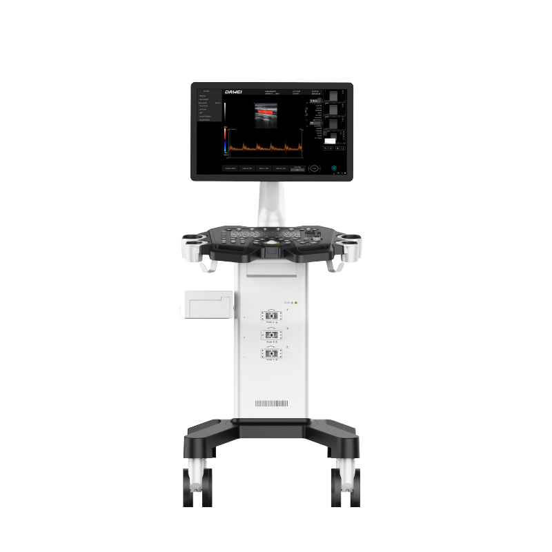 Equipamento de ultrassom de Doppler de cor de carrinho barato