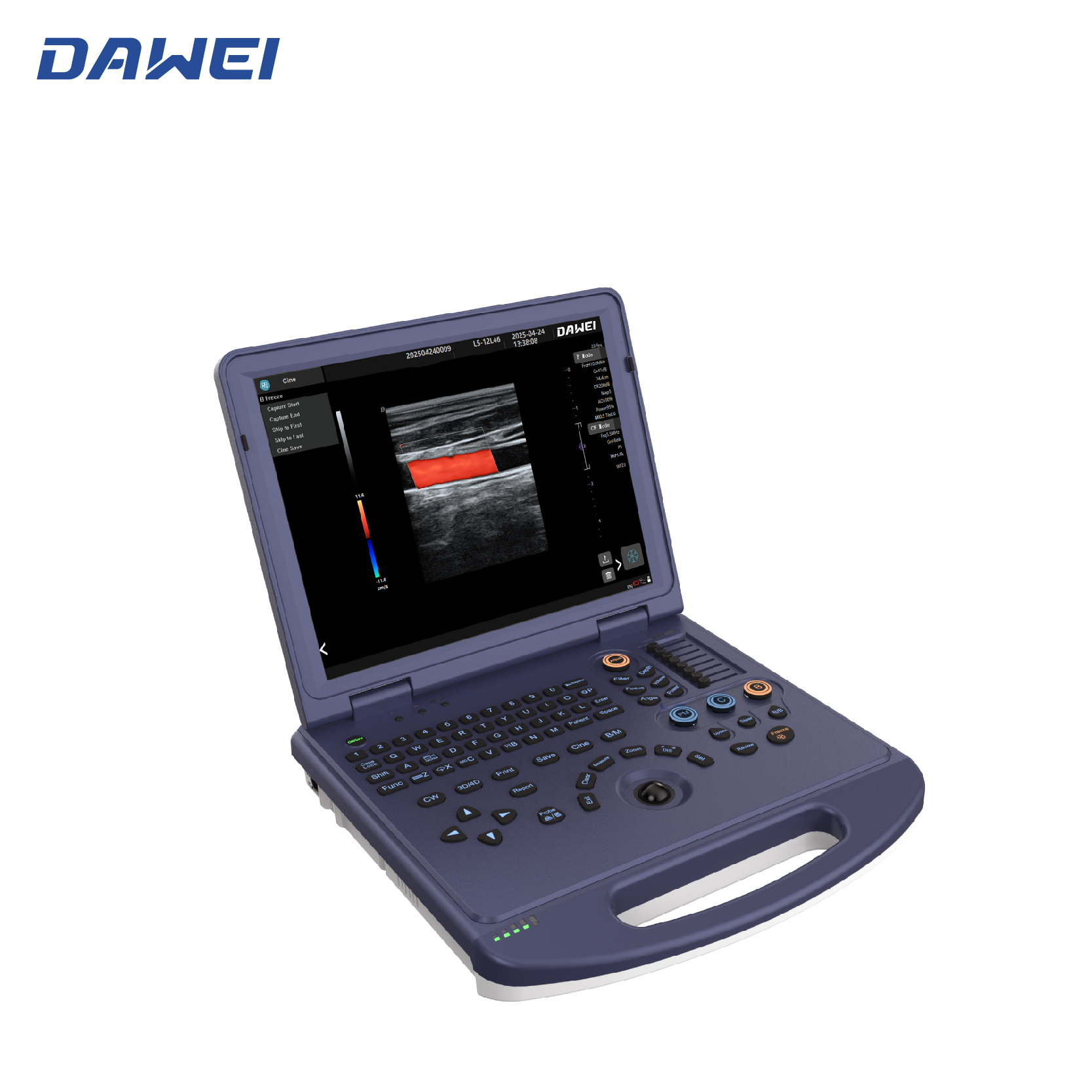 Máquina de ultrassom de cores do laptop com baixo preço