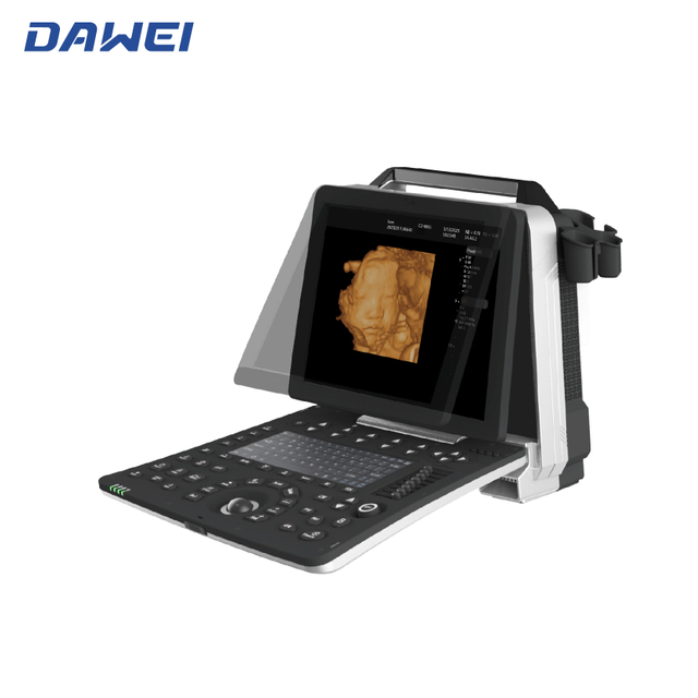 Máquina portátil barata de ultrassom 3D 4D