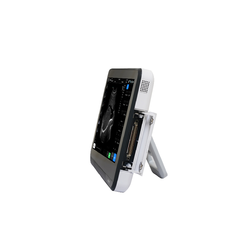 M&aacute;quina port&aacute;til de ultrassom com tela sens&iacute;vel ao toque