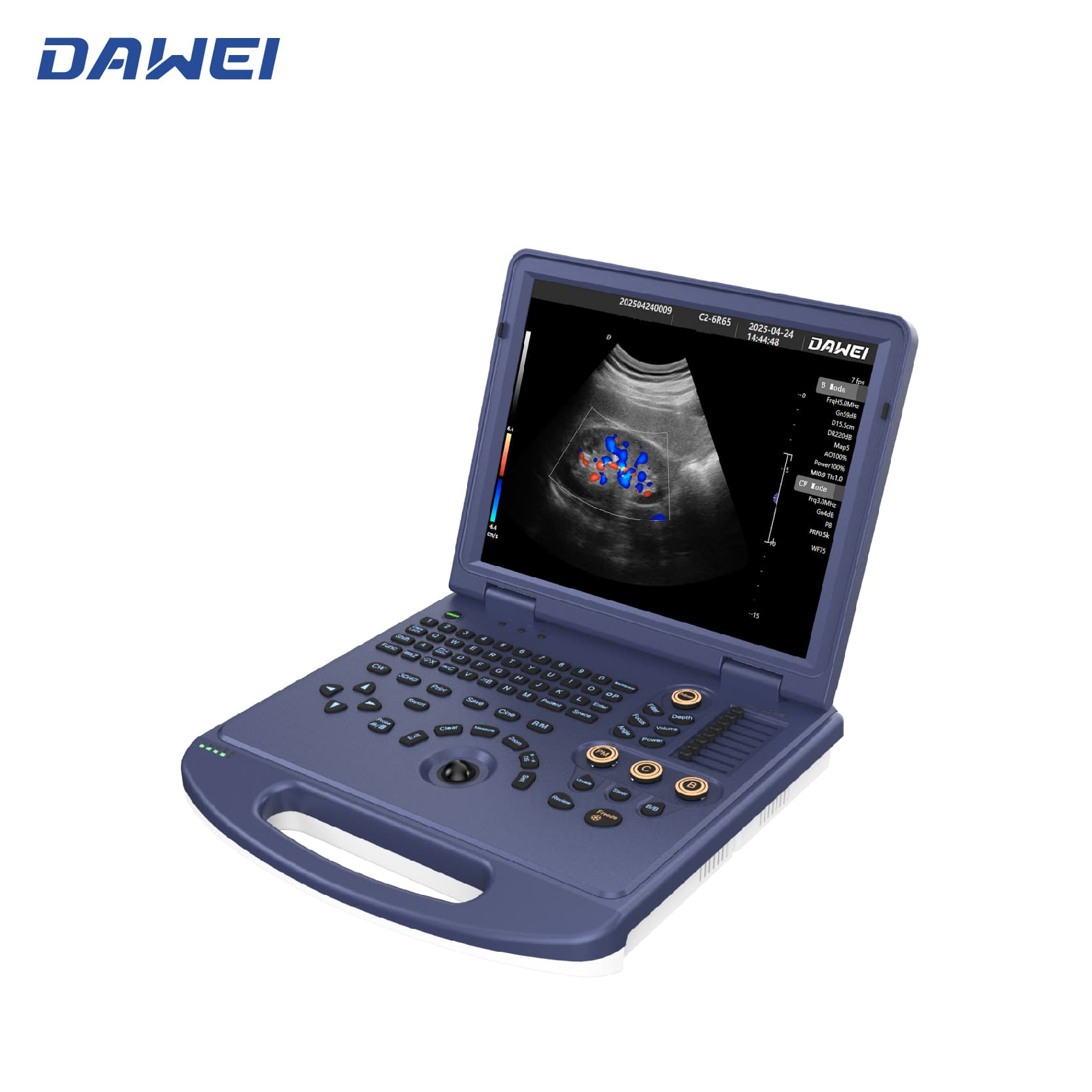 Máquina de ultrassom de cores do laptop com baixo preço