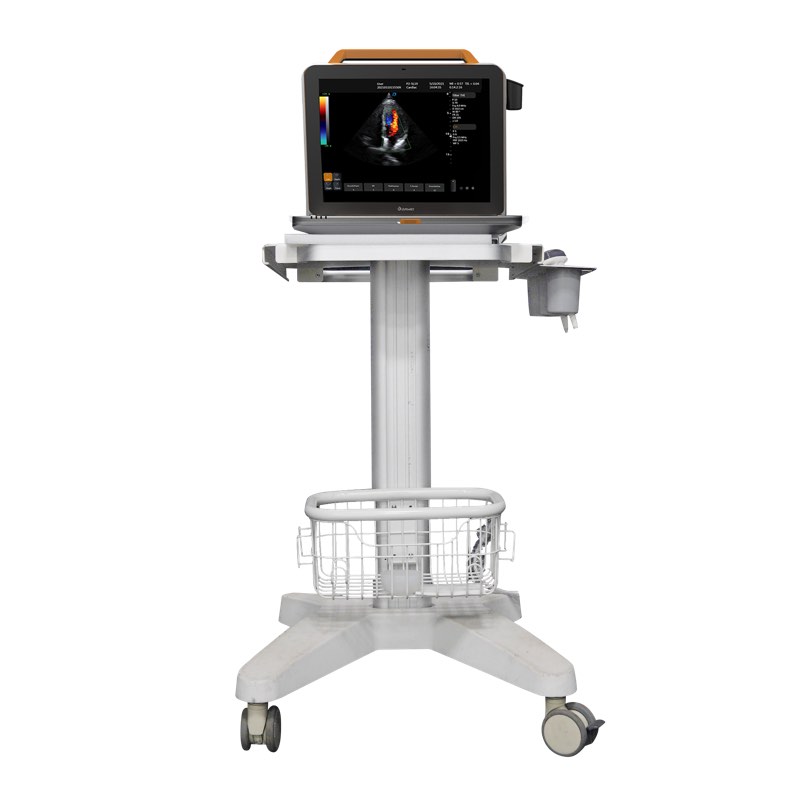 Máquina portátil de ultrassom Doppler colorido 3D 4D