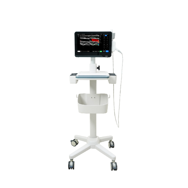 M&aacute;quina port&aacute;til de ultrassom com tela sens&iacute;vel ao toque