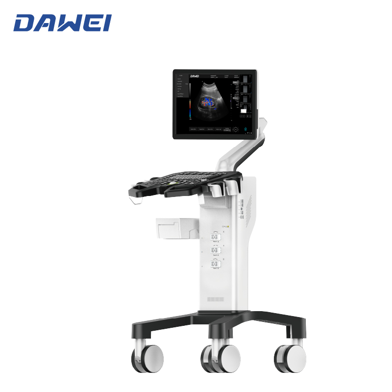 Equipamento de ultrassom de Doppler de cor de carrinho barato