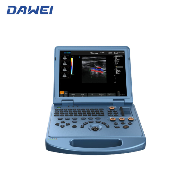 Sistema de ultrassom de laptop 4D acessível