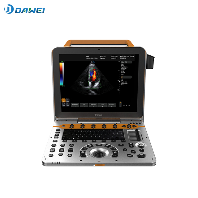 Máquina portátil de ultrassom Doppler colorido 3D 4D