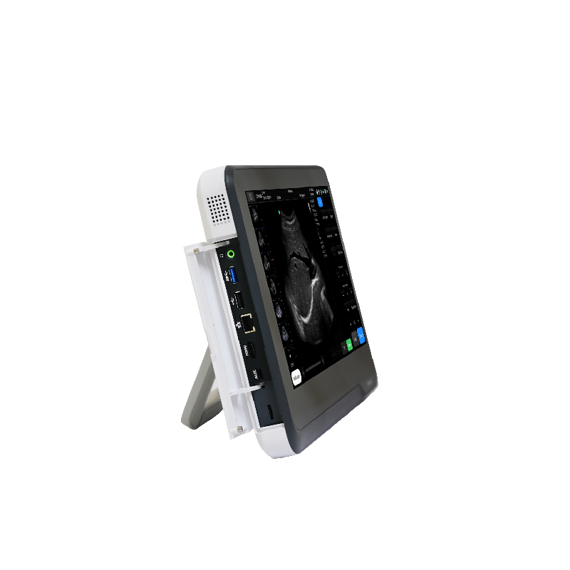 M&aacute;quina port&aacute;til de ultrassom com tela sens&iacute;vel ao toque