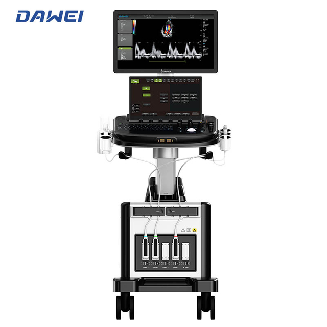 Sistema de ultrassom de Doppler em cores baseado em carrinho de ponta