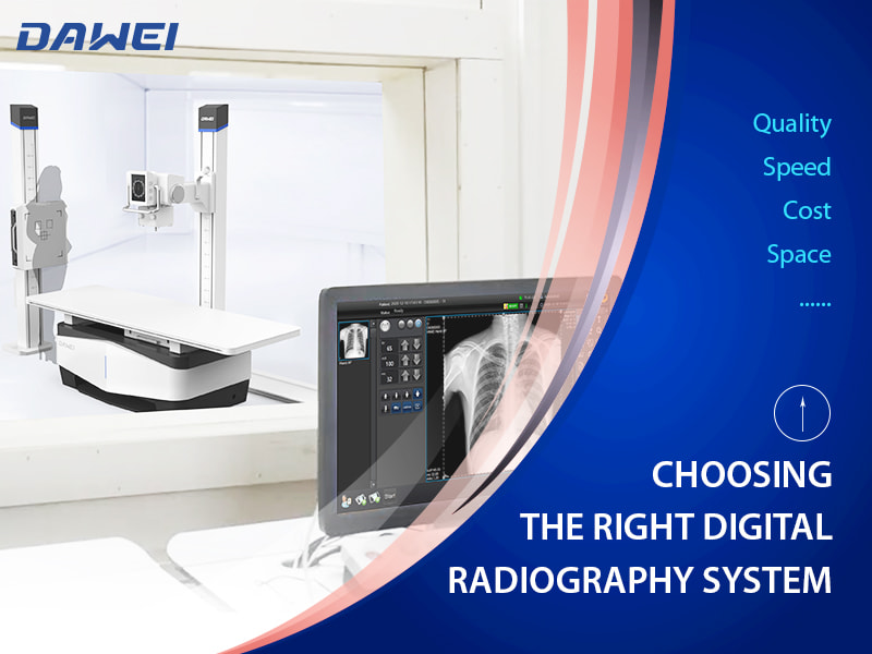 Escolha a m&aacute;quina de radiografia digital certa