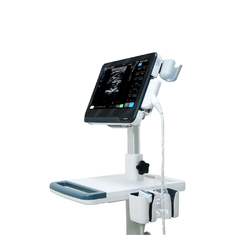 M&aacute;quina port&aacute;til de ultrassom com tela sens&iacute;vel ao toque