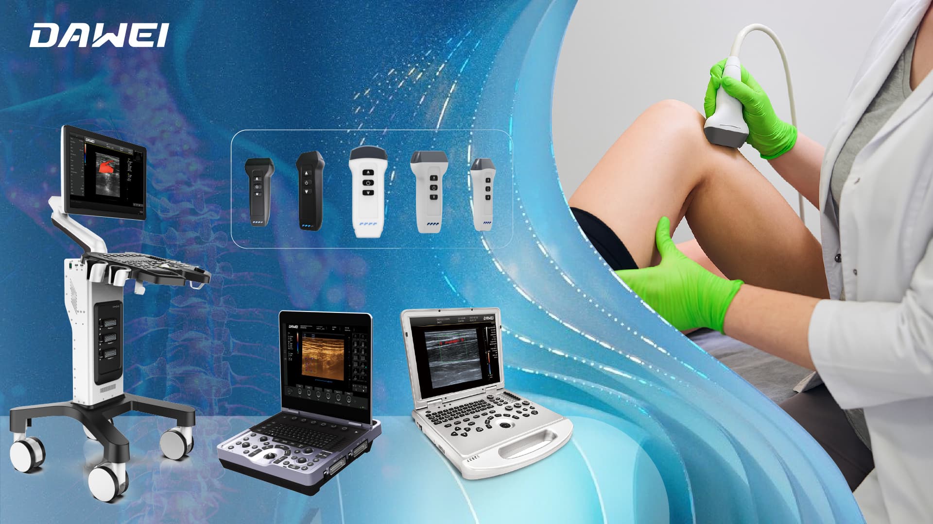MSK Ultrasound Machines Enabling Faster, Safer MSK Diagnosis　１.jpg