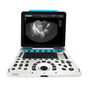 Máquina de ultrassom colorido OB&GYN 4D