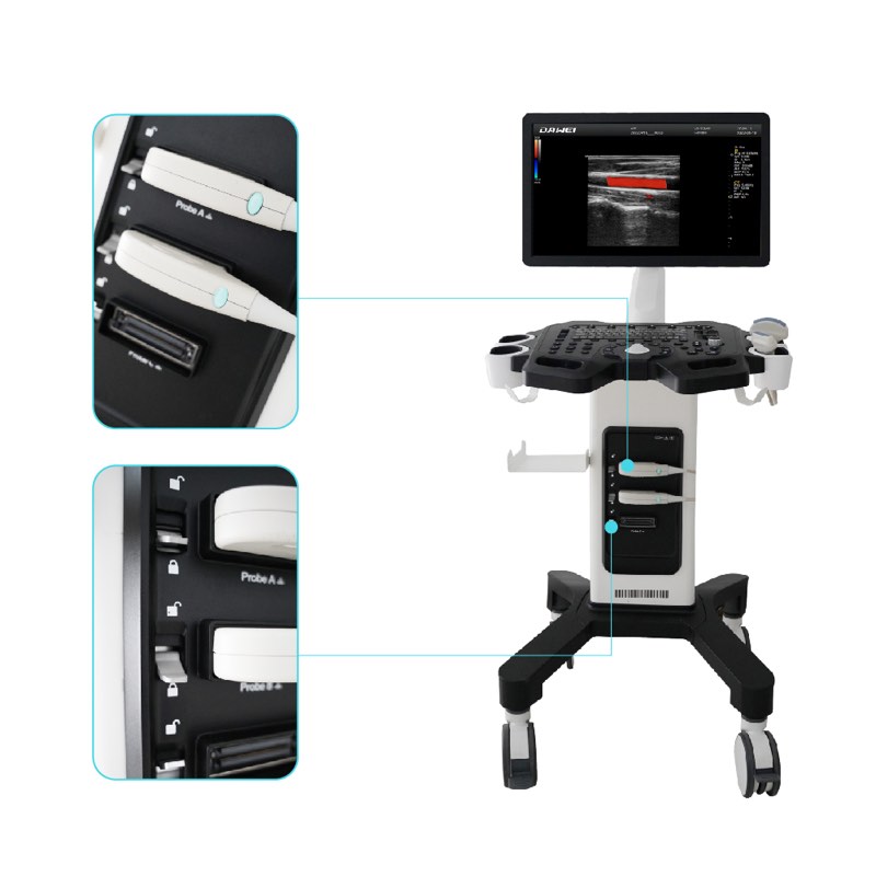 Scanner de ultrassom médico Doppler colorido para carrinho