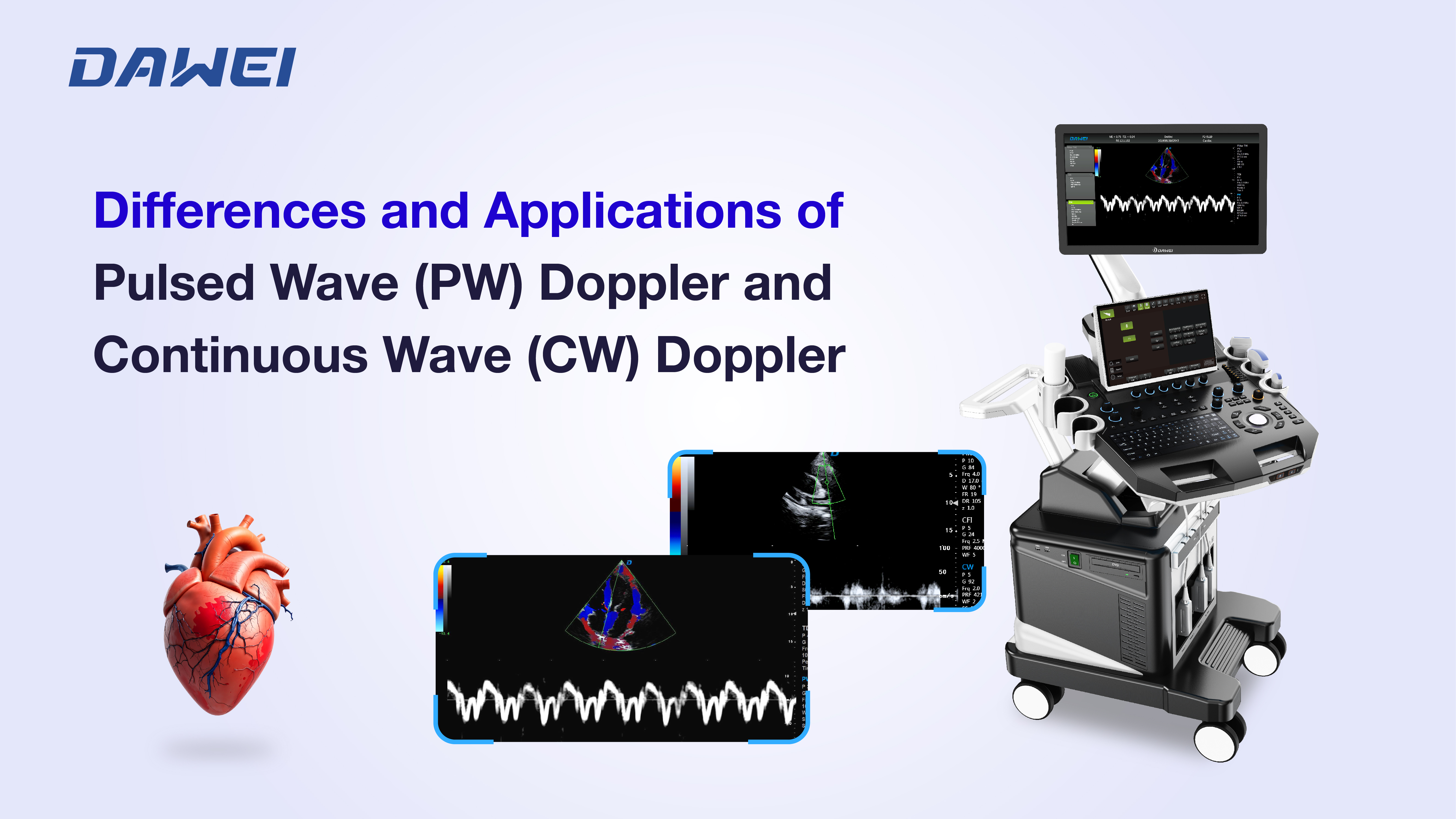 Doppler de Onda Pulsada (PW) e Doppler de Onda Contínua (CW)