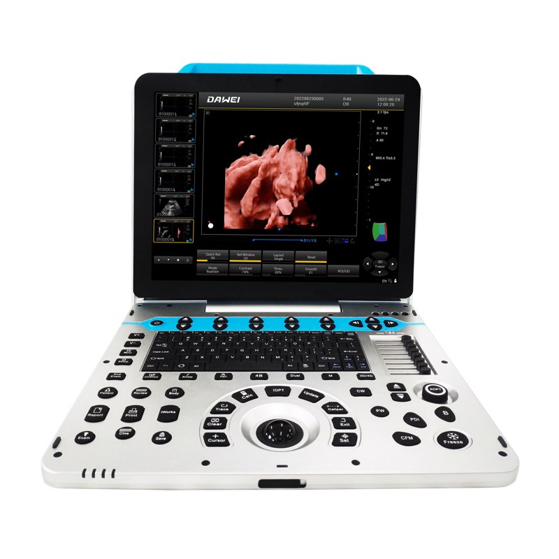 Máquina de ultrassom colorido OB&GYN 4D