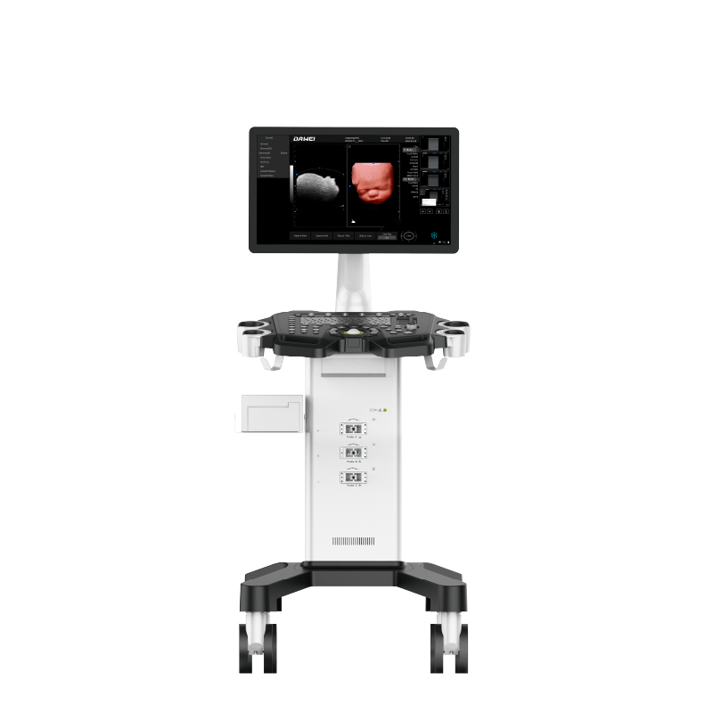 Equipamento de ultrassom de Doppler de cor de carrinho barato