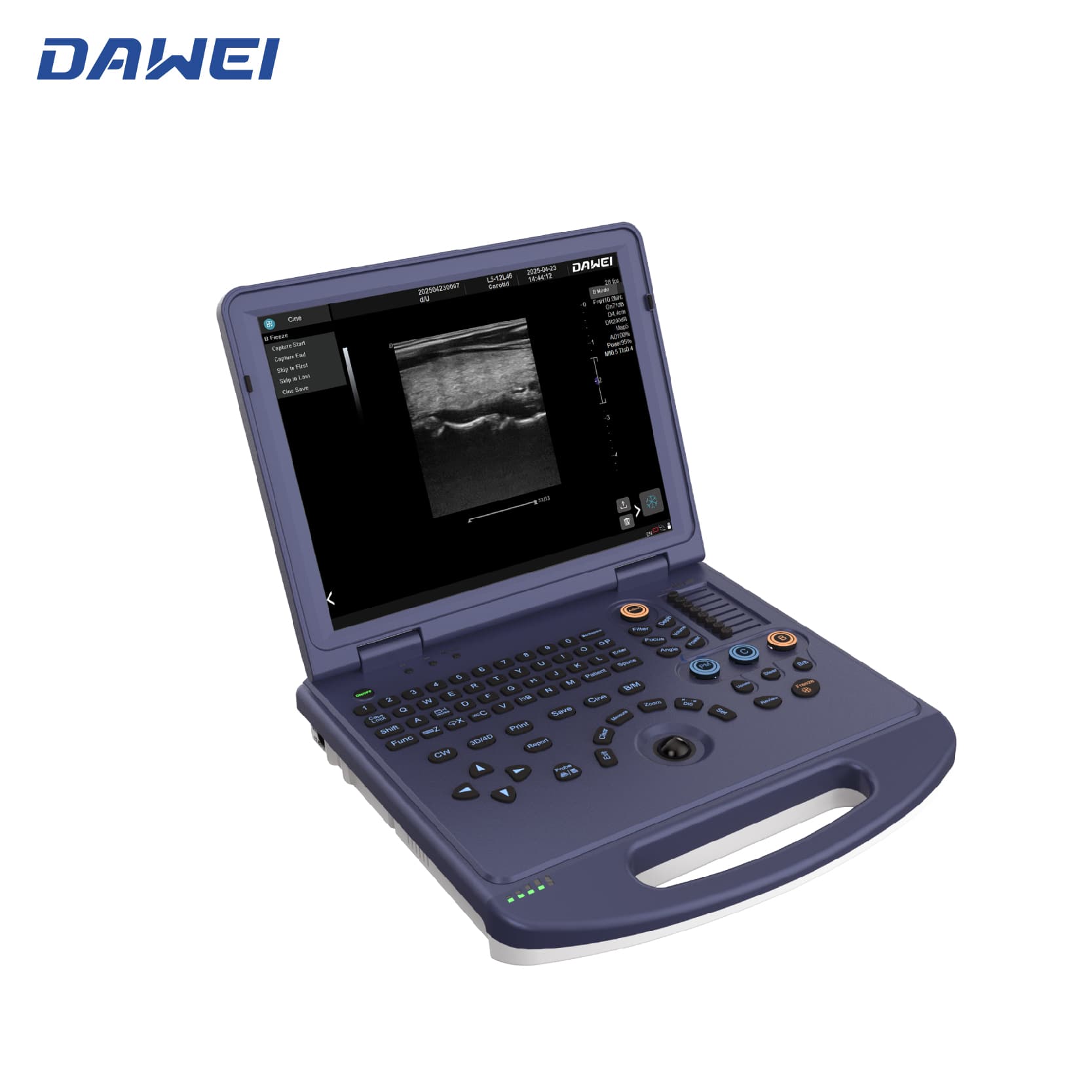 Máquina de ultrassom de cores do laptop com baixo preço