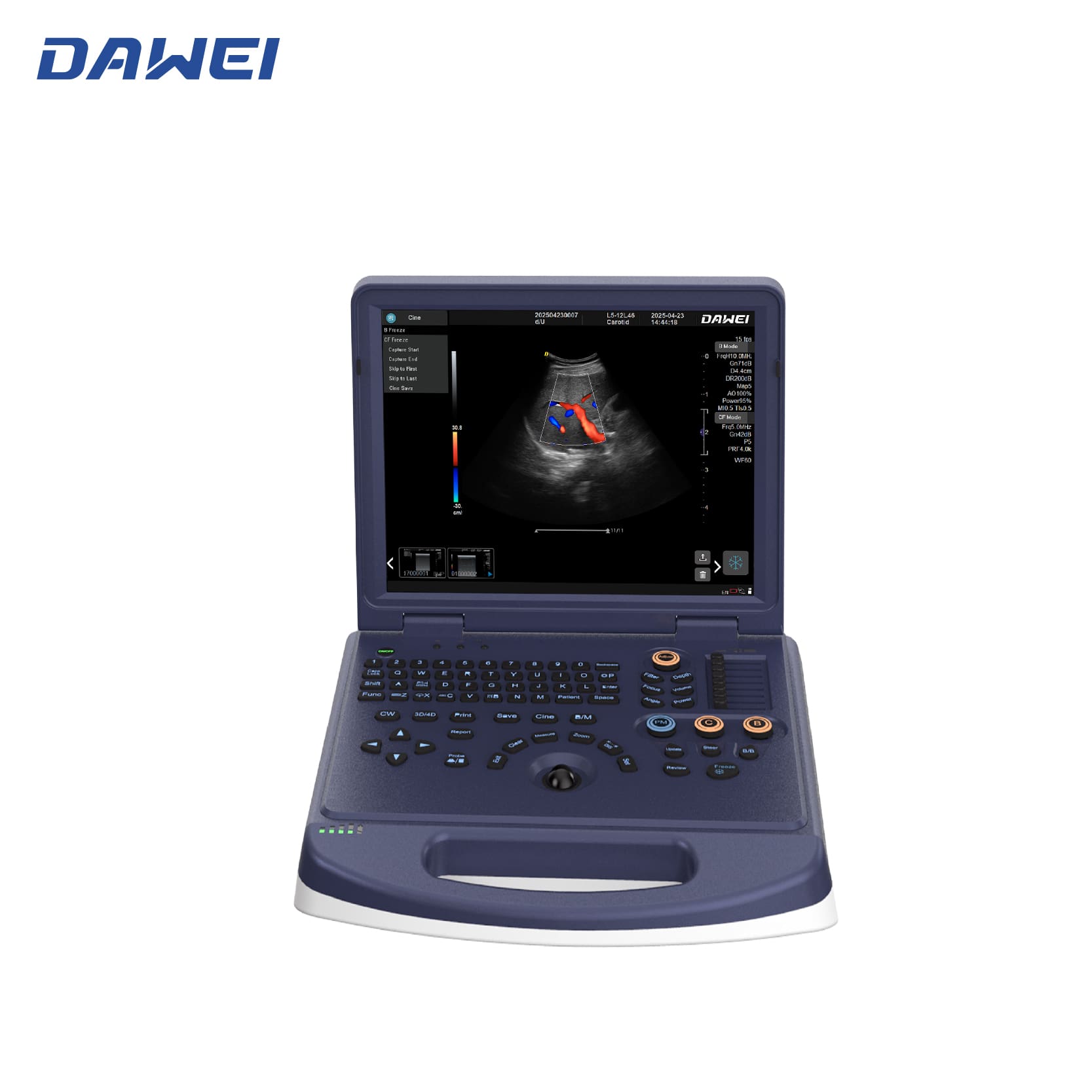 Máquina de ultrassom de cores do laptop com baixo preço