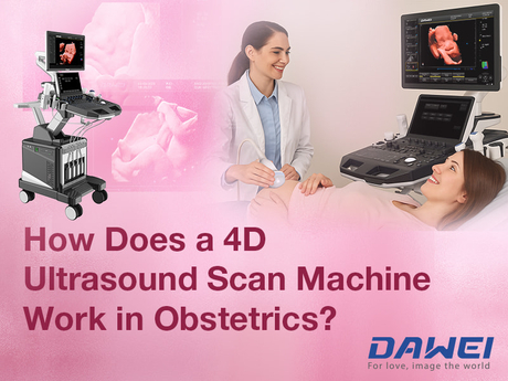 How Does a 4D Ultrasound Scan Machine Work in Obstetrics-800-600.jpg