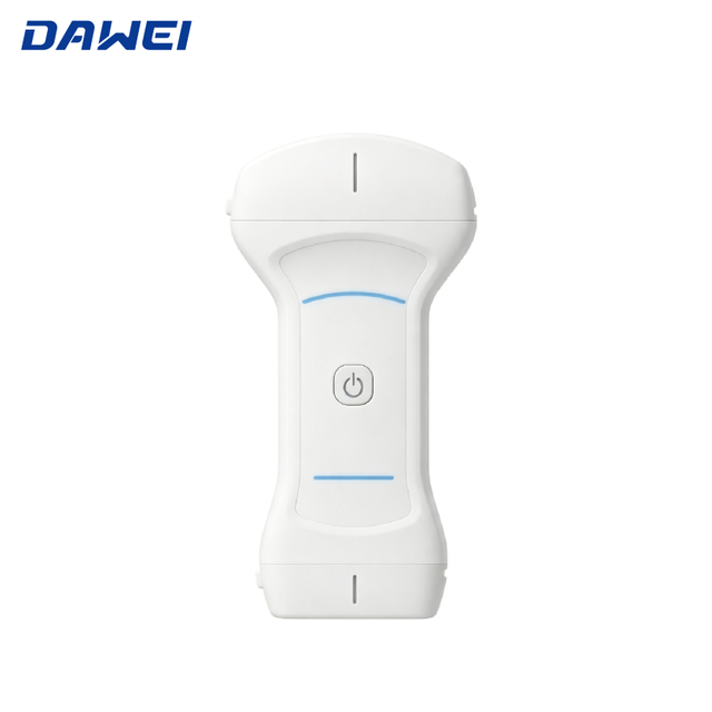 Scanner de ultrassom port&aacute;til barato com IA