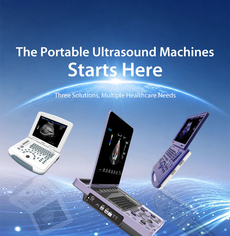 the portable ultrasound machine starts here