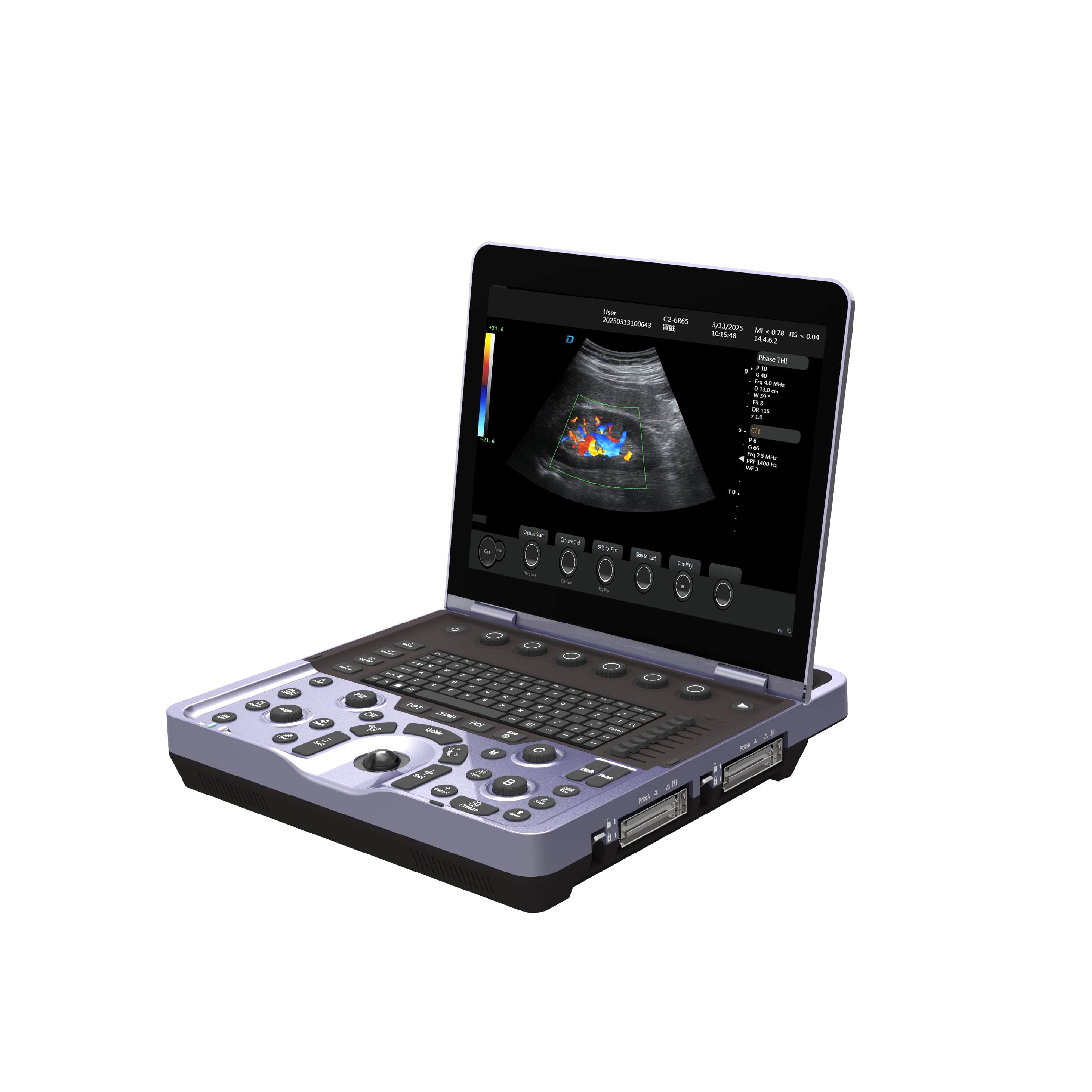 Sistema de ultrassom Doppler colorido para laptop