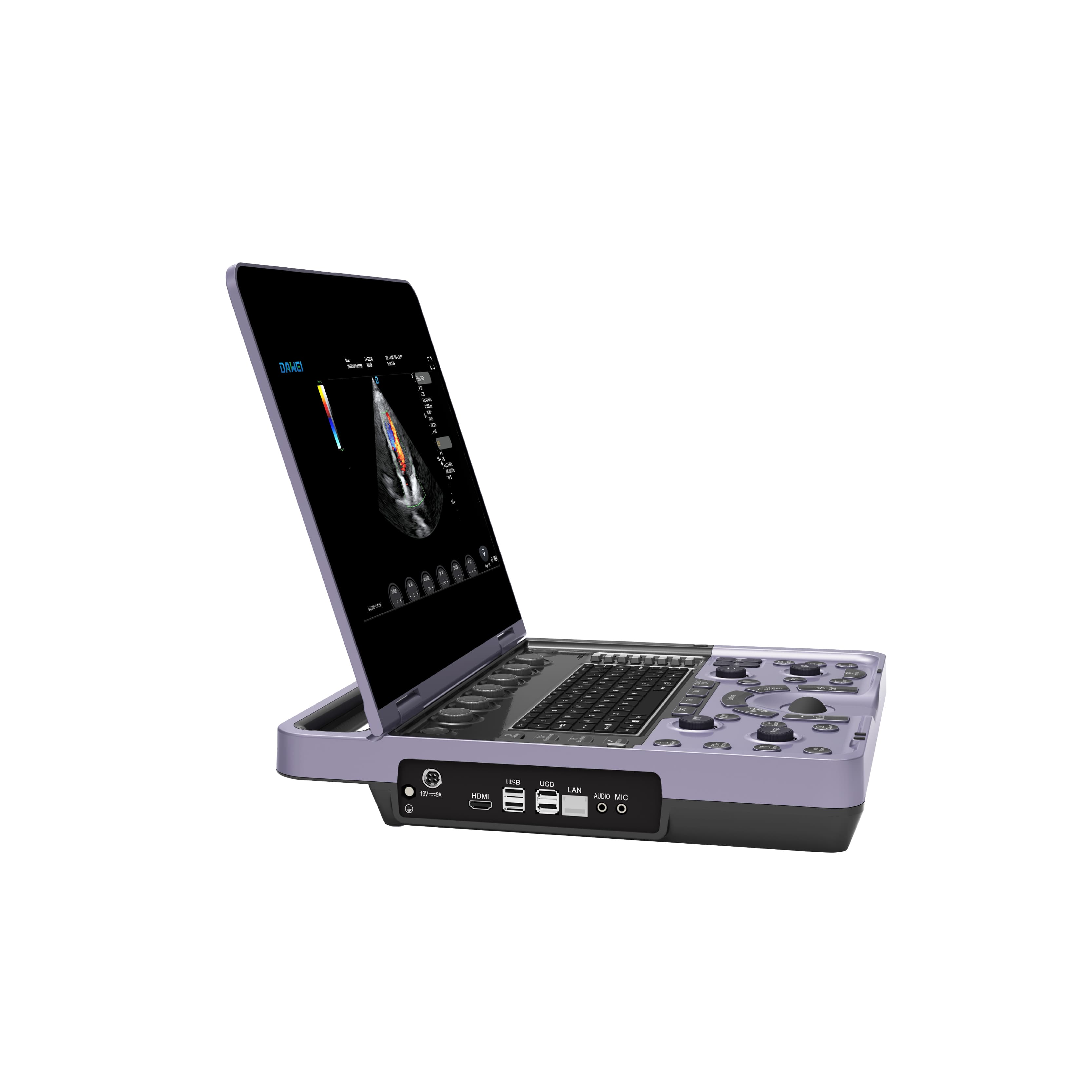 Sistema de ultrassom Doppler colorido para laptop