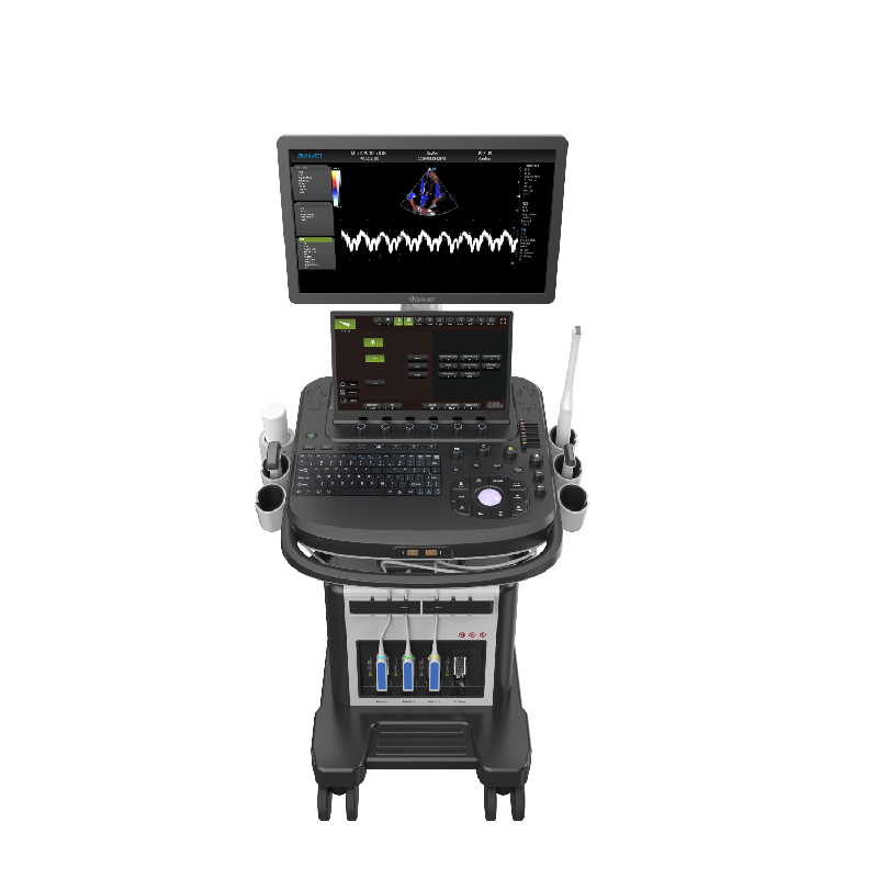 Sistemas de ultrassom Doppler de cor card&iacute;aca de bonde