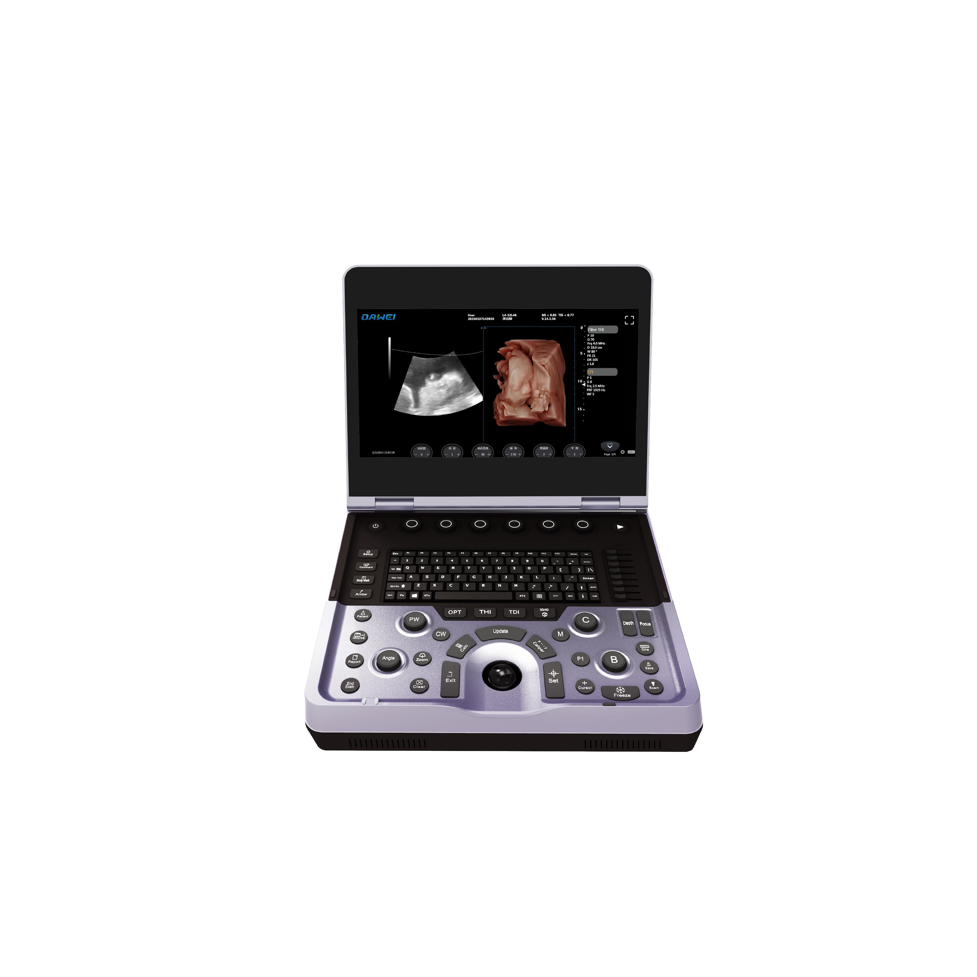 Sistema de ultrassom Doppler colorido para laptop